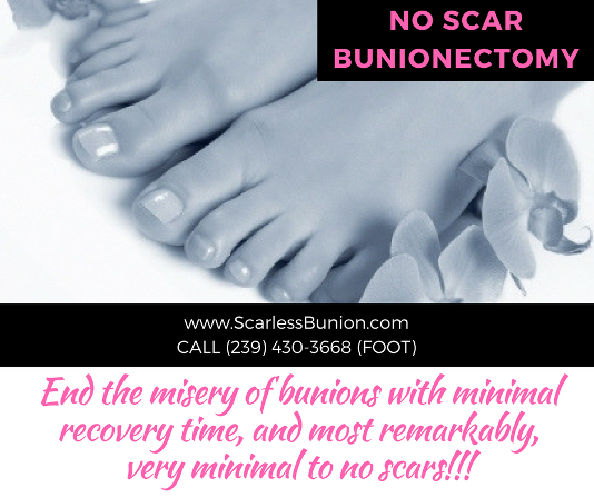 minimally-invasive-bunion-surgery